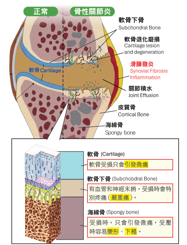 膝痛